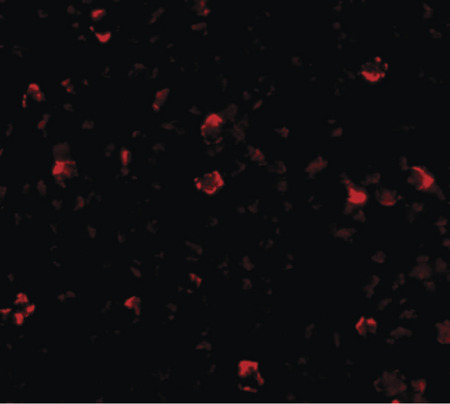 Immunofluorescence of IRGCb in A20 cells with IRGCb antibody at 20 ug/ml.