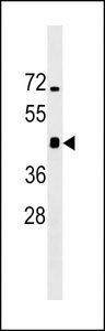Mouse Irgm1 western blot of mouse brain tissue lysates (35 ug/lane). The IRGM1 antibody detected the Irgm1 protein (arrow).