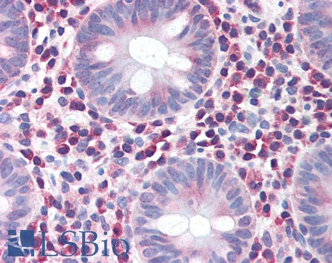 Anti-IRGM antibody IHC of human colon. Immunohistochemistry of formalin-fixed, paraffin-embedded tissue after heat-induced antigen retrieval. Antibody LS-B2732 concentration 5 ug/ml.