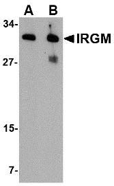 Western blot of IRGM in human brain lysate with IRGM antibody at (A) 1 and (B) 2 ug/ml.