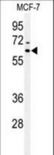 Western blot of IRGQ Antibody in MCF-7 cell line lysates (35 ug/lane). IRGQ (arrow) was detected using the purified antibody.
