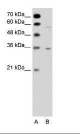 A: Marker, B: Jurkat Cell Lysate