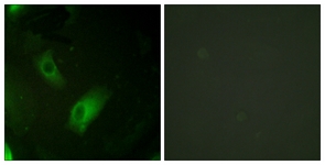 Immunofluorescence of HeLa cells, using IREB1 (Ab-138) Antibody. The picture on the right is treated with the synthesized peptide.