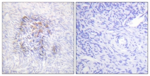 IHC of paraffin-embedded human ovary, using IREB1 (Phospho-Ser138) Antibody. The sample on the right was incubated with synthetic peptide.