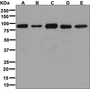 Western blot analysis on (A) human thyroid, (B) HeLa, (C) fetal kidney, (D) HepG2, and (E) T.T. lysates using anti-ACO1 antibody.
