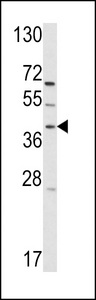 Western blot of hRai3-W343 in T47D cell line lysates (35 ug/lane). RAI3 (arrow) was detected using the purified antibody.