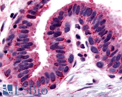 Anti-GPRC5A / RAI3 antibody LS-A3553 IHC of human breast. Immunohistochemistry of formalin-fixed, paraffin-embedded tissue after heat-induced antigen retrieval.