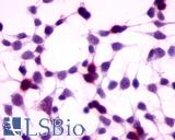 Anti-GPRC5A / RAI3 antibody LS-A3551 immunocytochemistry (ICC) staining of HEK293 human embryonic kidney cells transfected with GPRC5A / RAI3.