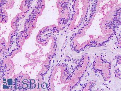 Anti-GPRC5A / RAI3 antibody IHC of human prostate. Immunohistochemistry of formalin-fixed, paraffin-embedded tissue after heat-induced antigen retrieval. Antibody LS-A1220 dilution 18-36 ug/ml.