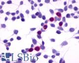 Anti-GPRC5A / RAI3 antibody LS-A1220 immunocytochemistry (ICC) staining of HEK293 human embryonic kidney cells transfected with GPRC5A / RAI3.