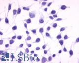 Anti-GPRC5A / RAI3 antibody LS-A1220 immunocytochemistry (ICC) staining of untransfected HEK293 human embryonic kidney cells.