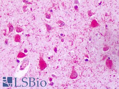 Anti-GPRC5A / RAI3 antibody IHC of human brain, neurons. Immunohistochemistry of formalin-fixed, paraffin-embedded tissue after heat-induced antigen retrieval. Antibody LS-A1222 dilution 4-10 ug/ml.