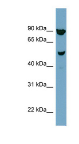 IRX2 antibody LS-C107894 Western blot of NCI-H226 cell lysate.