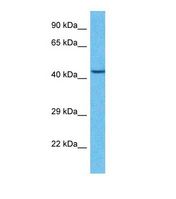 Western blot of Human Esophagus Tumor. IRX2 antibody dilution 1.0 ug/ml.