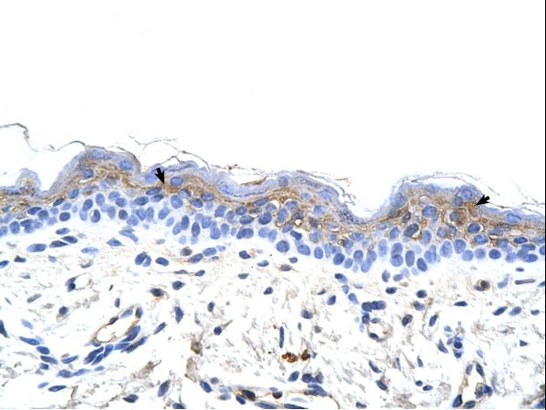 IRX3 antibody LS-C30531 was used in IHC to stain formalin-fixed, paraffin-embedded human skin.