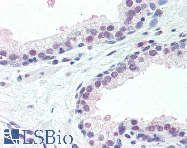 Anti-ISG15 antibody IHC of human prostate. Immunohistochemistry of formalin-fixed, paraffin-embedded tissue after heat-induced antigen retrieval. Antibody LS-B6673 concentration 10 ug/ml.