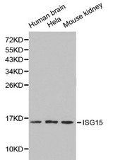 Western blot of ISG15 pAb in extracts from Human brain tissue, hela cells and mouse kidney tissue.