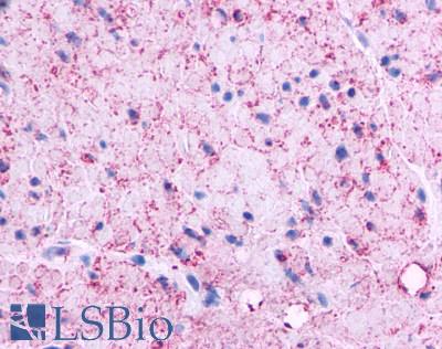 Anti-GPRC5C antibody LS-A4077 IHC of human stomach, muscularis propria. Immunohistochemistry of formalin-fixed, paraffin-embedded tissue after heat-induced antigen retrieval.