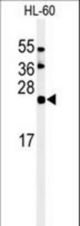 Western blot of ISG15 Antibody (C-term N151) in HL-60 cell line lysates (35 ug/lane). ISG15 (arrow) was detected using the purified antibody.