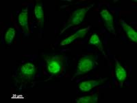 Immunostaining analysis in HeLa cells. HeLa cells were fixed with 4% paraformaldehyde and permeabilized with 0.1% Triton X-100 in PBS. The cells were immunostained with anti-ISL2 mAb.