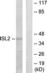 Western blot of extracts from 293 cells, using ISL2 Antibody. The lane on the right is treated with the synthesized peptide.