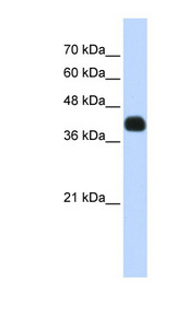 ISL2 / Islet 2 antibody LS-C101802 Western blot of Transfected 293T cell lysate.