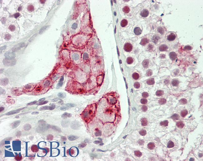 Human Testis: Formalin-Fixed, Paraffin-Embedded (FFPE)