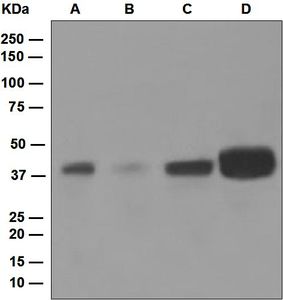 Western blot analysis on (A) K562, (B) HeLa, (C) Jurkat, and (D) SH-SY5Y cell lysates using anti-Islet-1 antibody.
