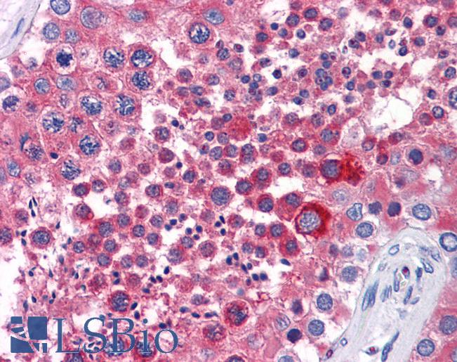 Anti-ISL1 / Islet 1 antibody IHC of human testis. Immunohistochemistry of formalin-fixed, paraffin-embedded tissue after heat-induced antigen retrieval. Antibody LS-B6125 dilution 1:200.