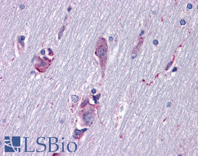 Anti-ISL1 / Islet 1 antibody IHC of human brain, cortex. Immunohistochemistry of formalin-fixed, paraffin-embedded tissue after heat-induced antigen retrieval. Antibody LS-B6125 dilution 1:200.