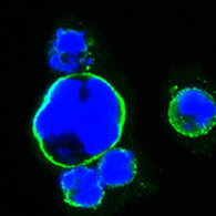 Confocal immunofluorescence of HEK293 cells transfected with full-length ISL1-hIgGFc using ISL1 mouse monoclonal antibody (green). Blue: DRAQ5 fluorescent DNA dye.
