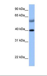 Fetal muscle lysate. Antibody concentration: 1.0 ug/ml. Gel concentration: 12%.