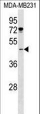 ISL1 Antibody western blot of MDA-MB231 cell line lysates (35 ug/lane). The ISL1 antibody detected the ISL1 protein (arrow).