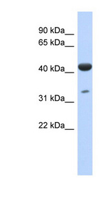 ISPD antibody LS-C112227 Western blot of Fetal Lung lysate.