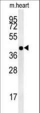 hCG_1745121 Antibody western blot of mouse heart tissue lysates (15 ug/lane). The CG_1745121 antibody detected CG_1745121 protein (arrow).