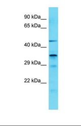Western blot of Human COLO205. IST1 antibody dilution 1.0 ug/ml.
