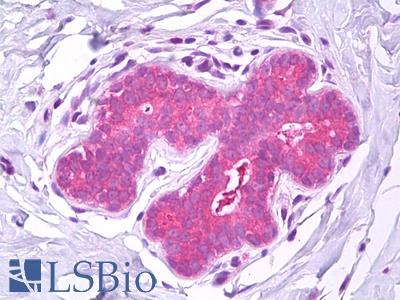 Anti-IST1 antibody IHC of human breast. Immunohistochemistry of formalin-fixed, paraffin-embedded tissue after heat-induced antigen retrieval. Antibody LS-B7315 concentration 10 ug/ml.