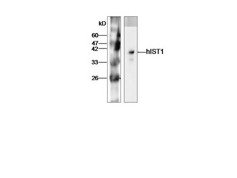 Western Blot analysis