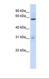 721_B cell lysate. Antibody concentration: 1.0 ug/ml. Gel concentration: 12%.