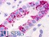 Anti-GPRC5D antibody LS-A568 IHC of human kidney, renal tubule. Immunohistochemistry of formalin-fixed, paraffin-embedded tissue after heat-induced antigen retrieval.