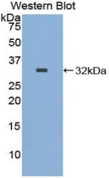 Western blot of recombinant ITFG1 / TIP.