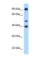 ITFG2 antibody LS-C146120 Western blot of HT1080 Cell lysate. Antibody concentration 1 ug/ml.