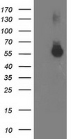 HEK293T cells were transfected with the pCMV6-ENTRY control (Left lane) or pCMV6-ENTRY ITFG2 (Right lane) cDNA for 48 hrs and lysed. Equivalent amounts of cell lysates (5 ug per lane) were separated by SDS-PAGE and immunoblotted with anti-ITFG2.