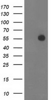 HEK293T cells were transfected with the pCMV6-ENTRY control (Left lane) or pCMV6-ENTRY ITFG2 (Right lane) cDNA for 48 hrs and lysed. Equivalent amounts of cell lysates (5 ug per lane) were separated by SDS-PAGE and immunoblotted with anti-ITFG2.