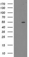 HEK293T cells were transfected with the pCMV6-ENTRY control (Left lane) or pCMV6-ENTRY ITFG2 (Right lane) cDNA for 48 hrs and lysed. Equivalent amounts of cell lysates (5 ug per lane) were separated by SDS-PAGE and immunoblotted with anti-ITFG2.