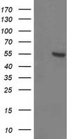 HEK293T cells were transfected with the pCMV6-ENTRY control (Left lane) or pCMV6-ENTRY ITFG2 (Right lane) cDNA for 48 hrs and lysed. Equivalent amounts of cell lysates (5 ug per lane) were separated by SDS-PAGE and immunoblotted with anti-ITFG2.