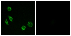 Immunofluorescence of MCF7 cells, using GPRC5D Antibody. The picture on the right is treated with the synthesized peptide.