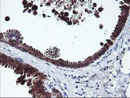 IHC of paraffin-embedded Human breast tissue using anti-ITFG2 mouse monoclonal antibody.