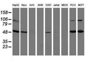 Western blot of extracts (35 ug) from 9 different cell lines by using anti-ITFG2 monoclonal antibody.