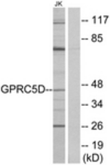Western blot of extracts from Jurkat cells, using GPRC5D Antibody. The lane on the right is treated with the synthesized peptide.
